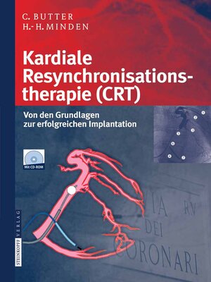 cover image of Kardiale Resynchronisationstherapie (CRT)